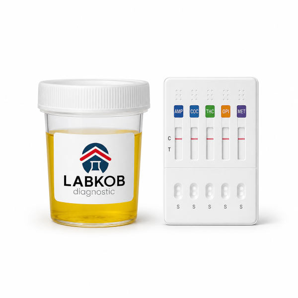Análisis de Sulfonilurea en orina - estudio de laboratorio LABKOB