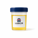2, 5 Hexanodiona En Orina - estudio de laboratorio LABKOB