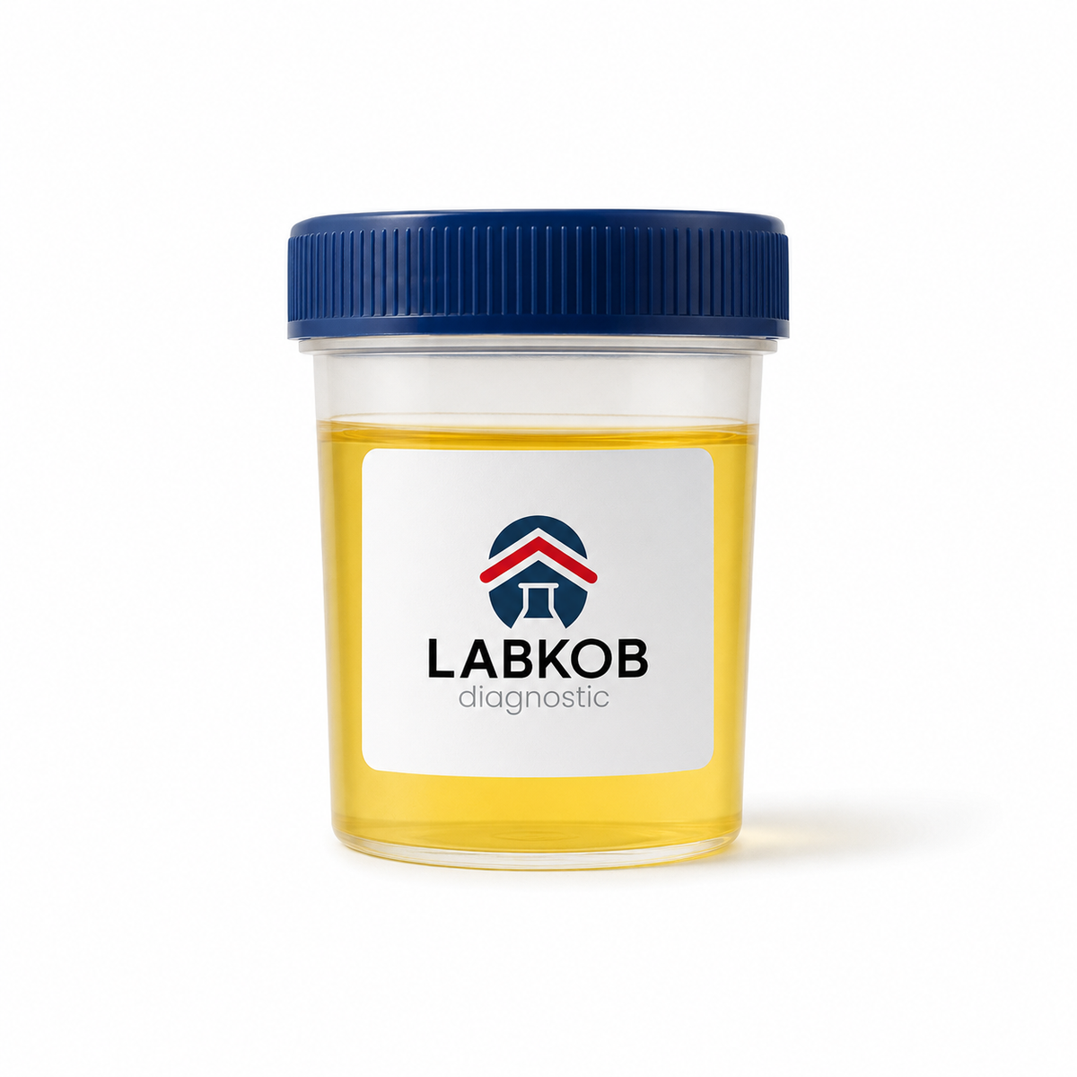 labkob_orina_general 2, 5 Hexanodiona En Orina - estudio de laboratorio LABKOB