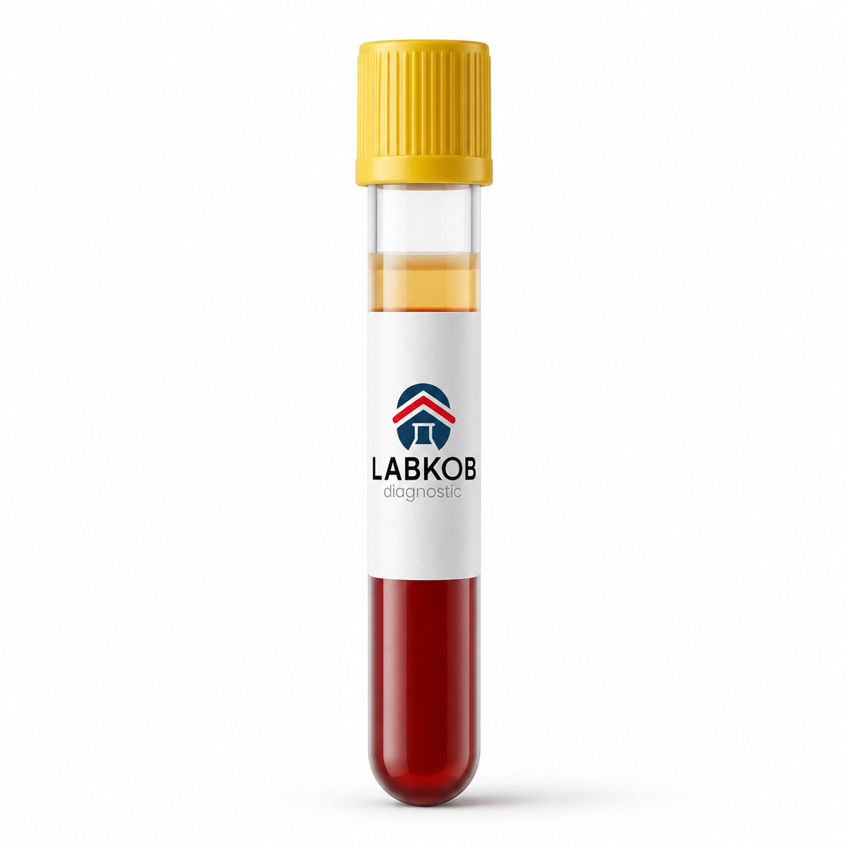 labkob_sangre_tapa_amarilla Parathormona (PTH rP) - estudio de laboratorio LABKOB
