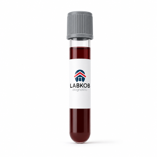1.5 Anhidroglucitol (Glycomark) - estudio de laboratorio LABKOB