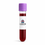 Glucosa 6-fosfato deshidrogenasa - estudio de laboratorio LABKOB