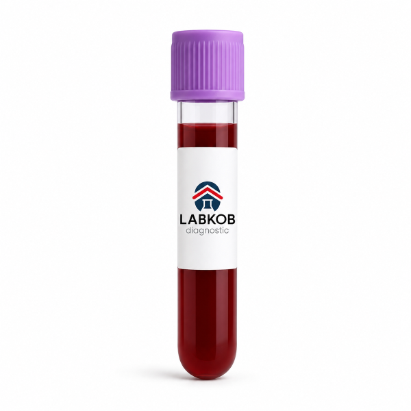 Glucosa 6-fosfato deshidrogenasa - estudio de laboratorio LABKOB