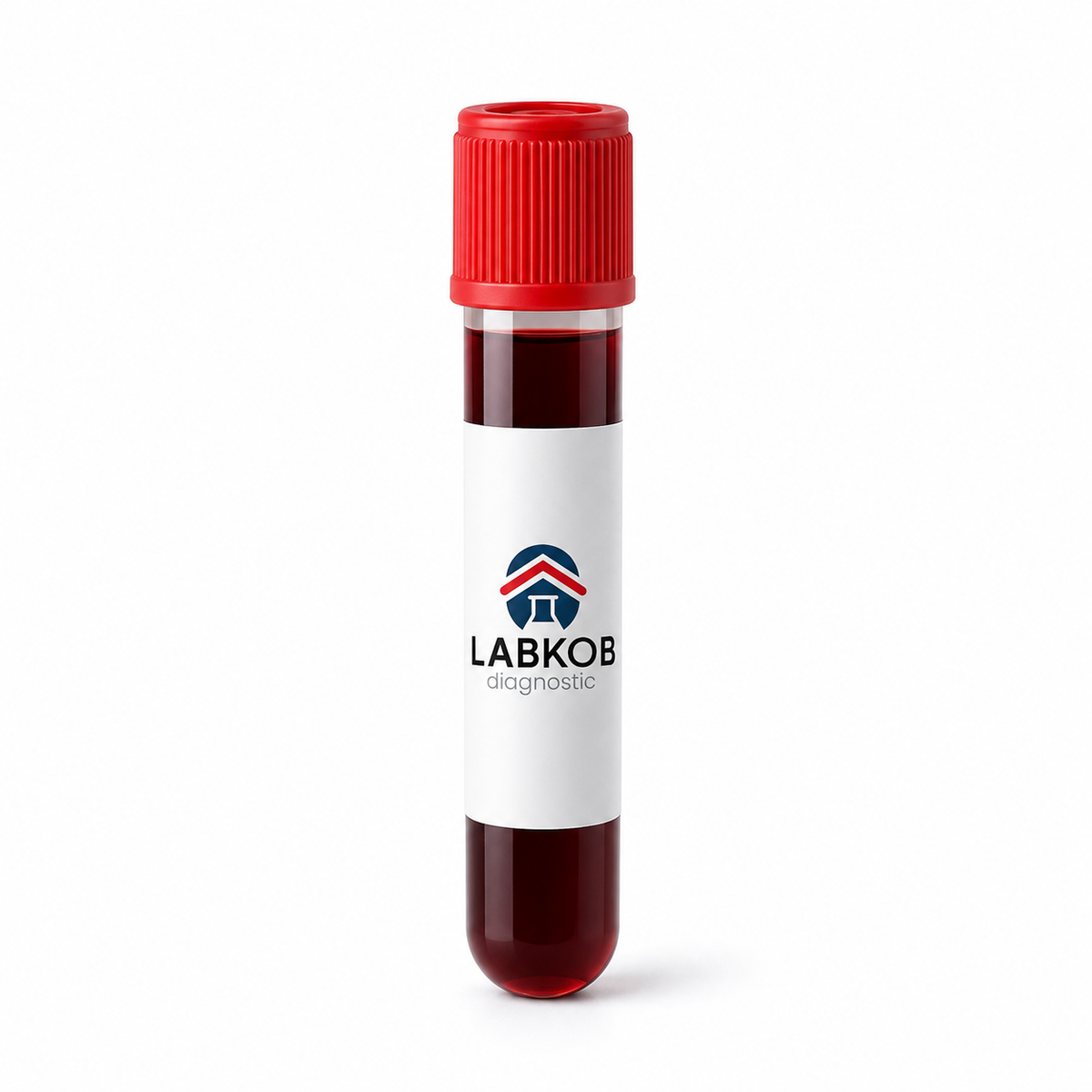 labkob_sangre_tapa_roja Detección de Trastornos de Almacenamiento Lisosoma - estudio de laboratorio LABKOB