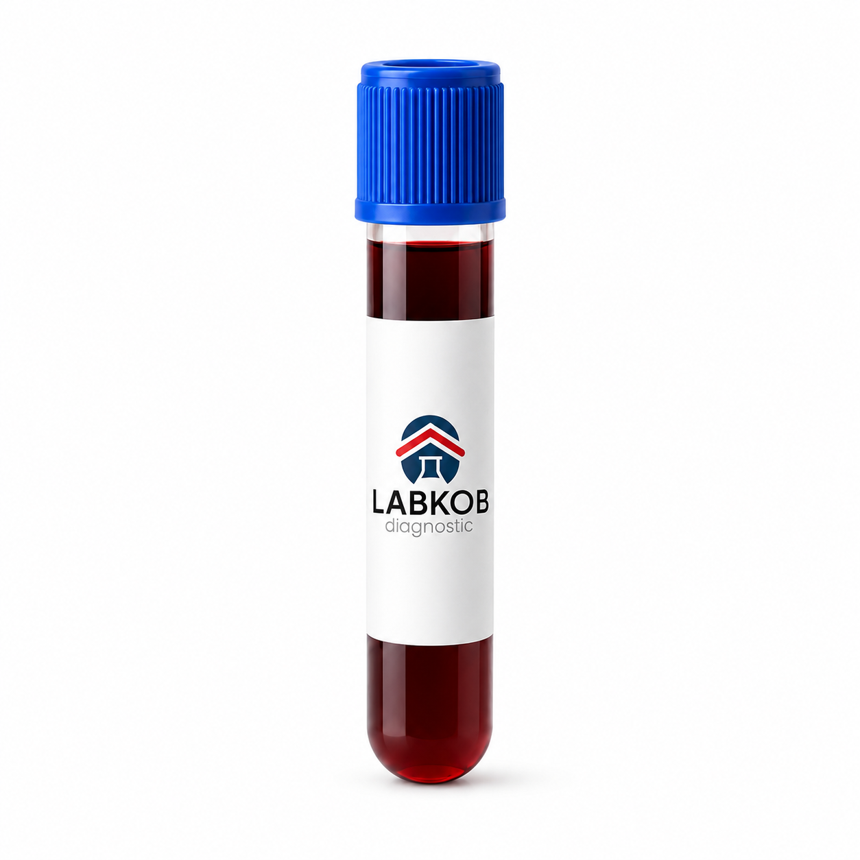 Coagulacion-1.png ADAMT13 Inhibidor y actividad - estudio de laboratorio LABKOB